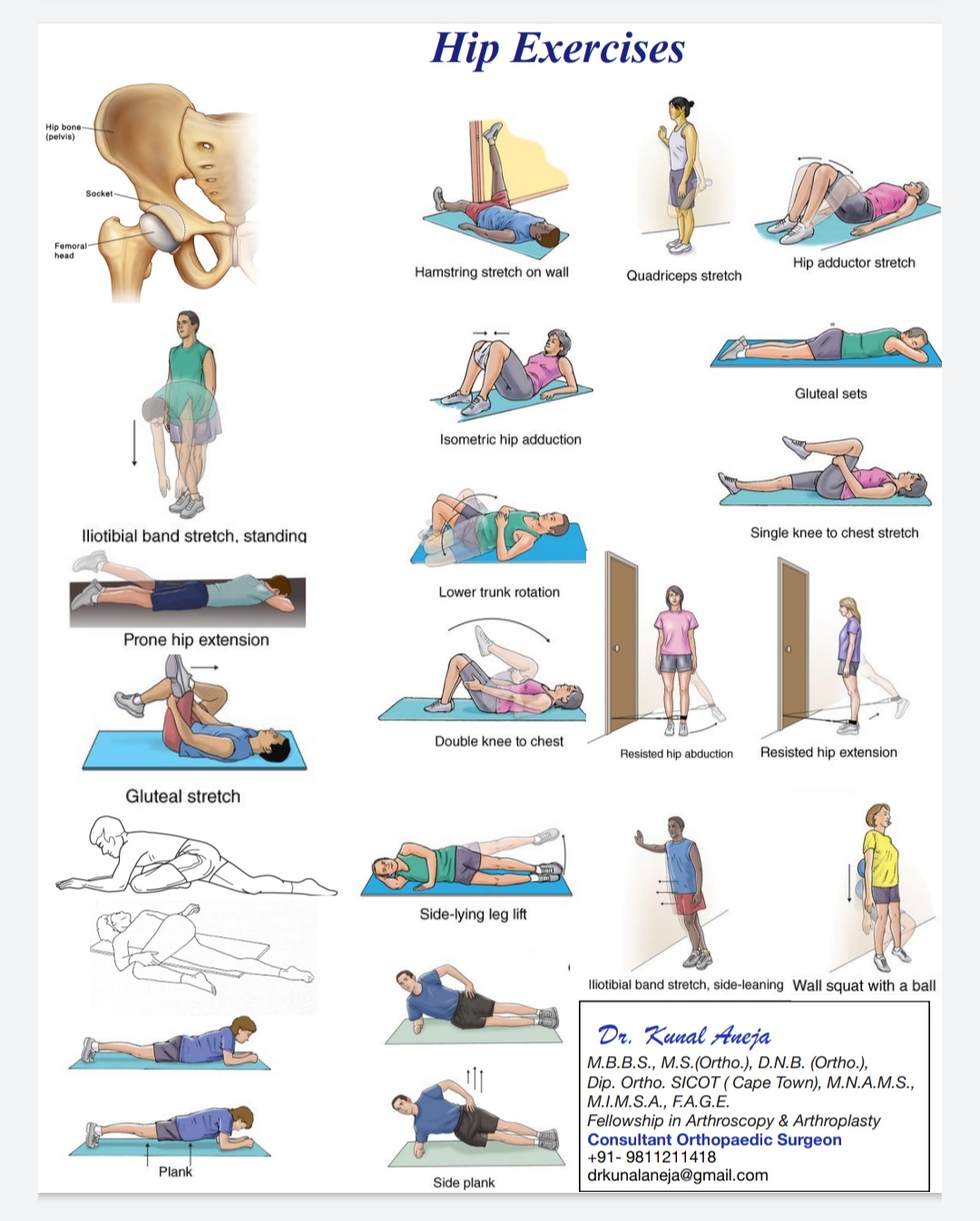 Patient Information : Exercises – Dr. Kunal Aneja