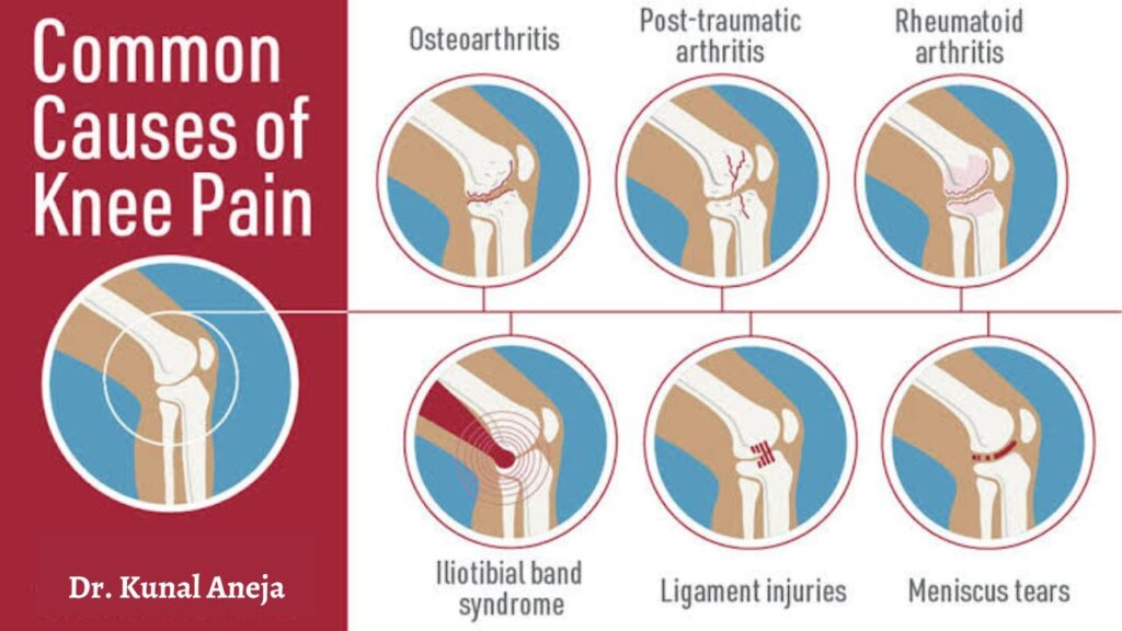 knee pain treatment