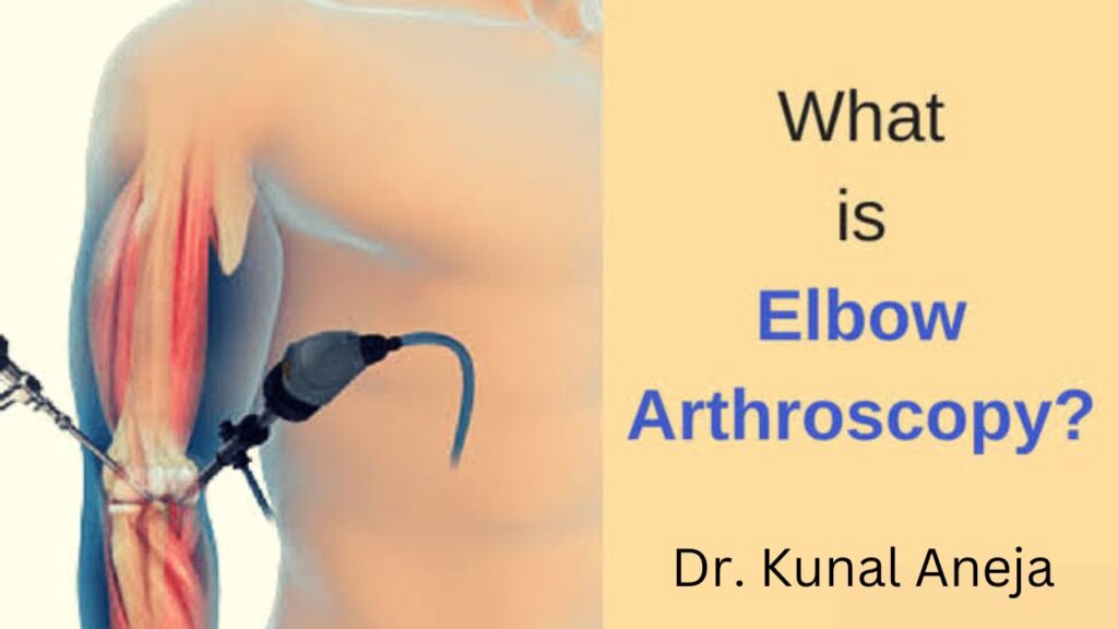 Elbow Arthroscopy Treatment in West Delhi