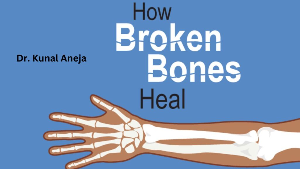 Bones knows. Broken Bones logo. What is used to Heal the Fracture.