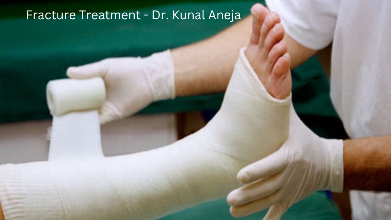 Fracture Treatment In Delhi Dr Kunal Aneja