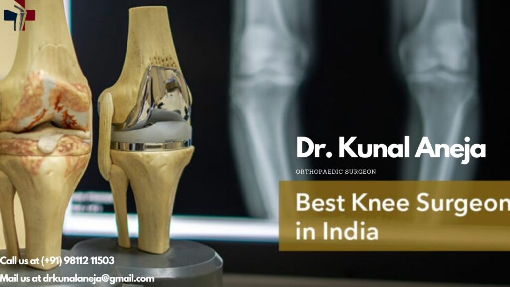 Knee Replacement Surgeon in Delhi