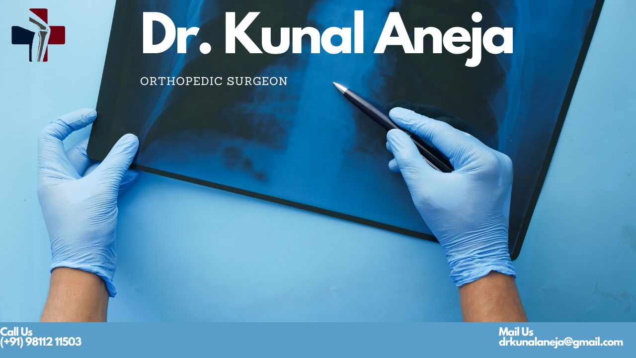 Best Orthopedic Surgeon in Delhi: Dr Kunal Aneja a Knee, Hip Replacement expert