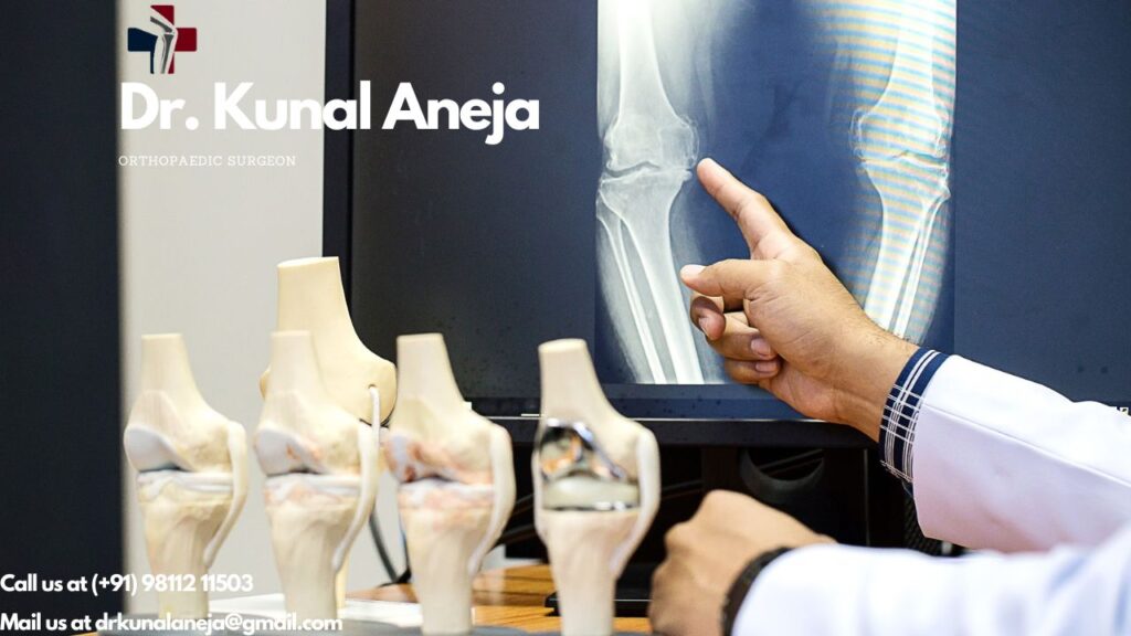 Dr. Kunal expert Orthopedic Surgeon.