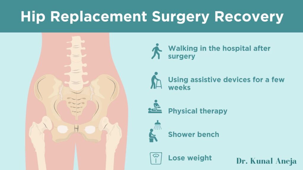 Hip Replacement surgeons in New Delhi