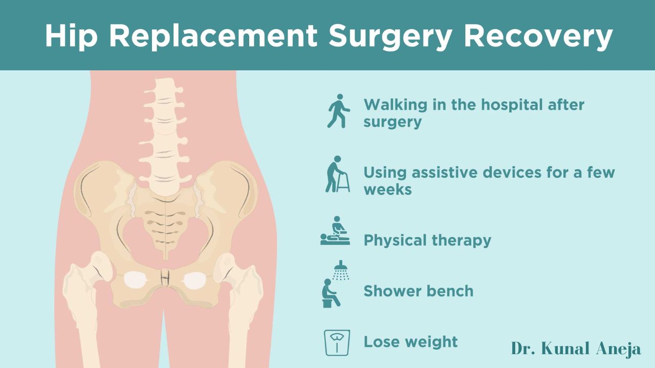 Hip Replacement surgeons in New Delhi Dr. Kunal Aneja