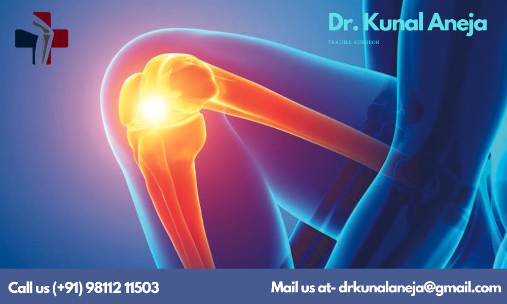 Orthopaedic surgeon in Delhi