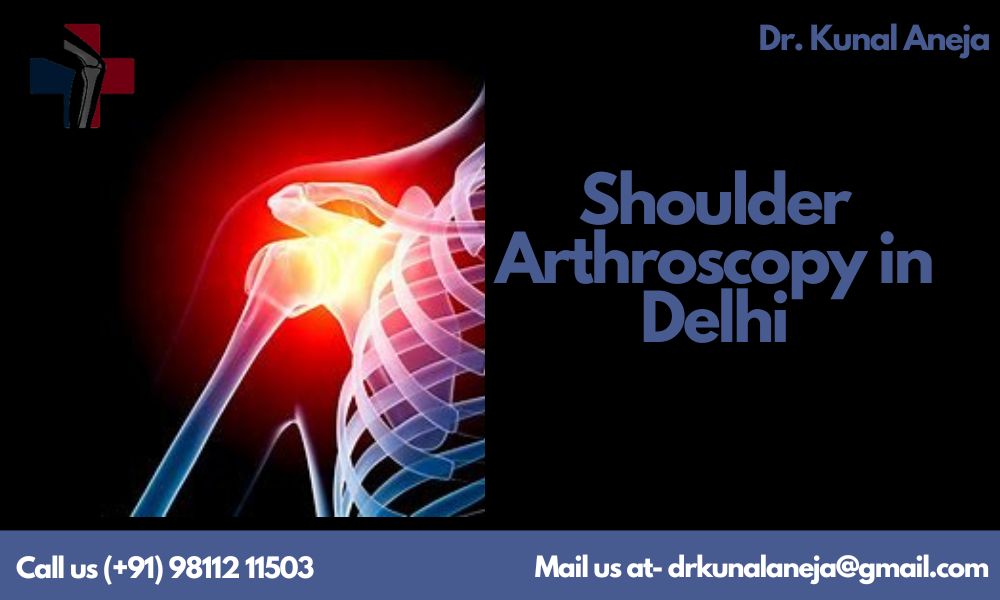 Shoulder Arthroscopy in Delhi with Dr. Kunal Aneja