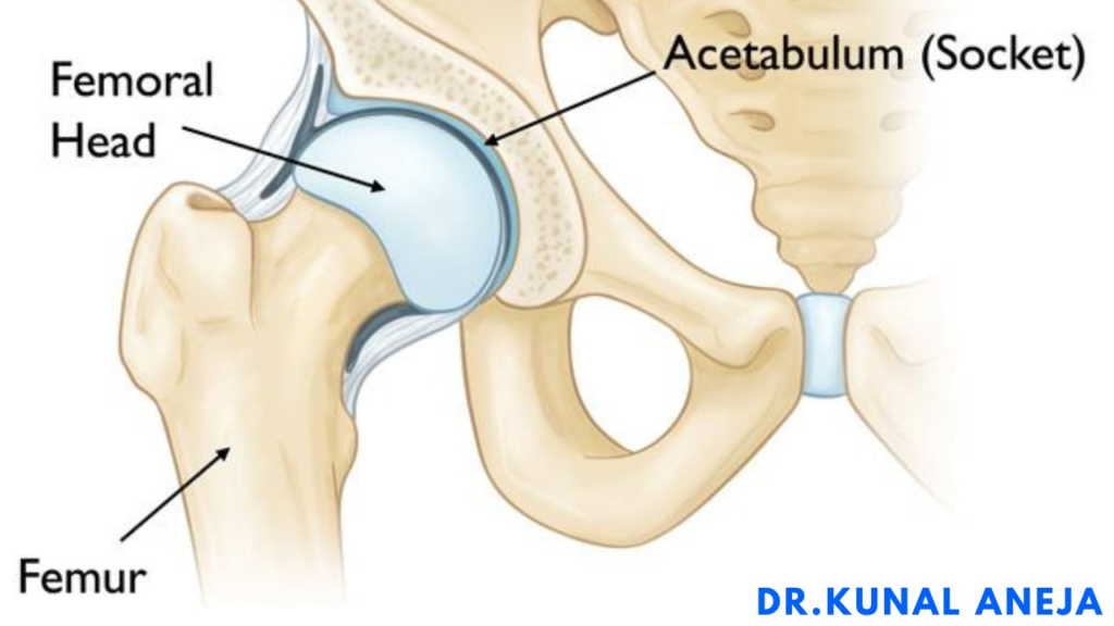 Hip Replacement 