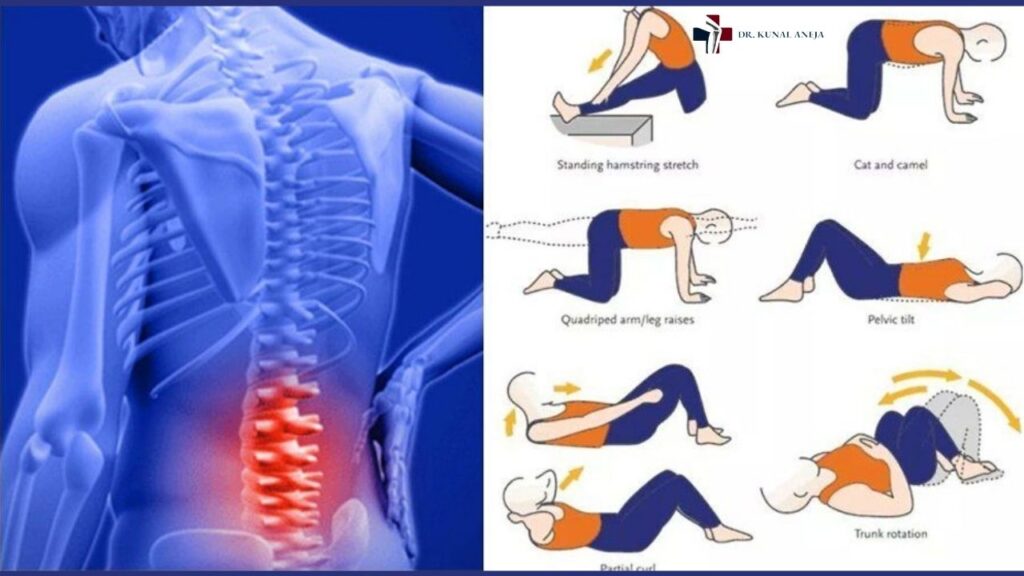 Lower Back Pain Treatment in Delhi | Dr Kunal Aneja 