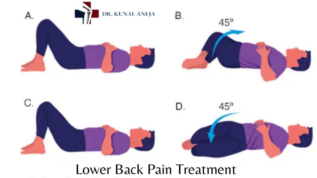 Lower Back Pain Treatment in Delhi | Dr Kunal Aneja 