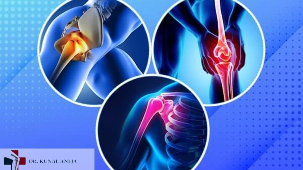 Joint Replacement Surgery in Delhi