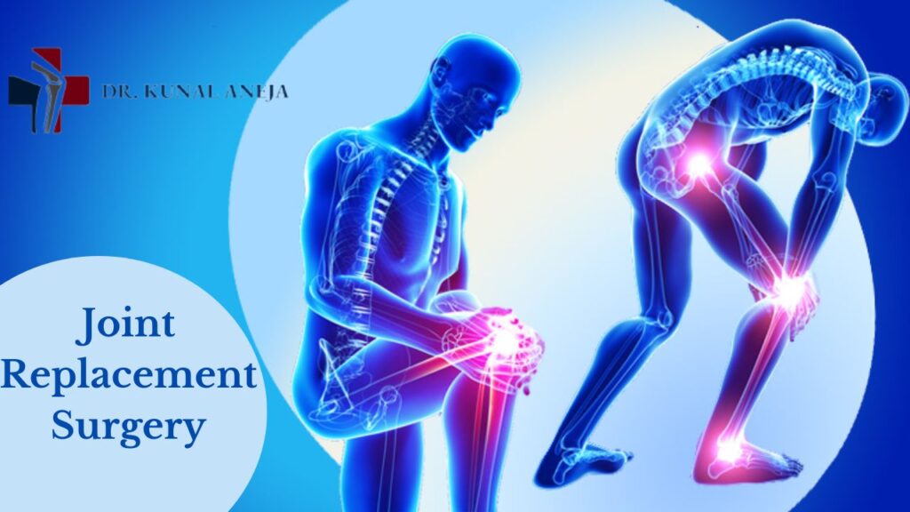 Joint Replacement Surgery