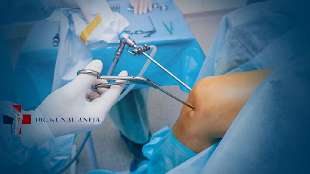 Dr Kunal Aneja | Best ACL Surgeon in Delhi