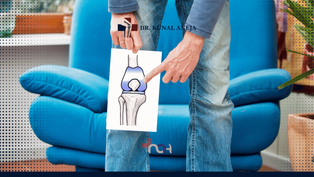 Total Knee Replacement Risks and Benefits