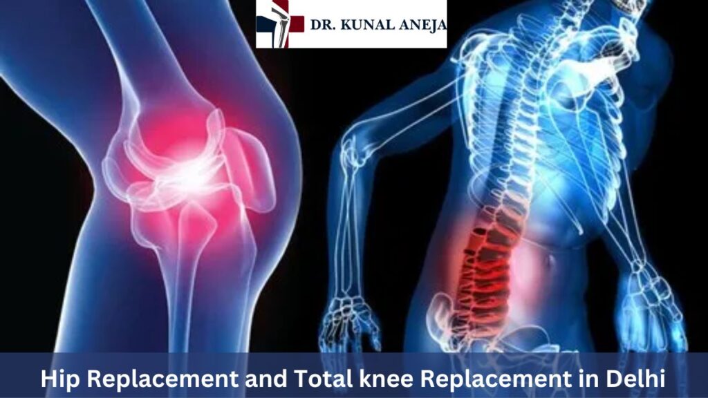 Hip Replacement and Total knee Replacement in Delhi