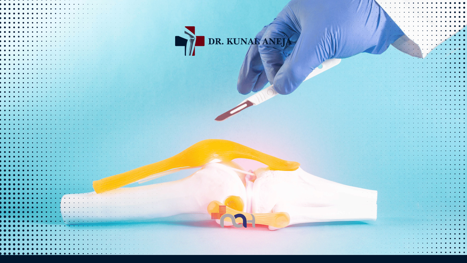 Total Knee Replacement in Delhi | Your Guide to Better Mobility