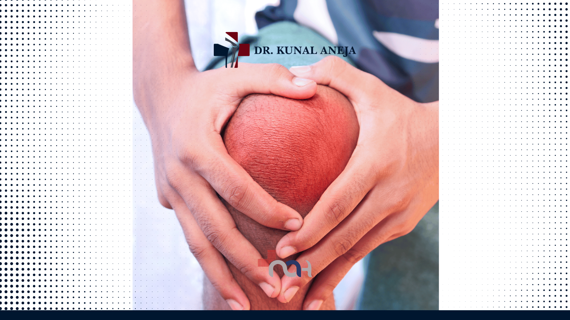 Total Knee Replacement Surgery in Delhi | India