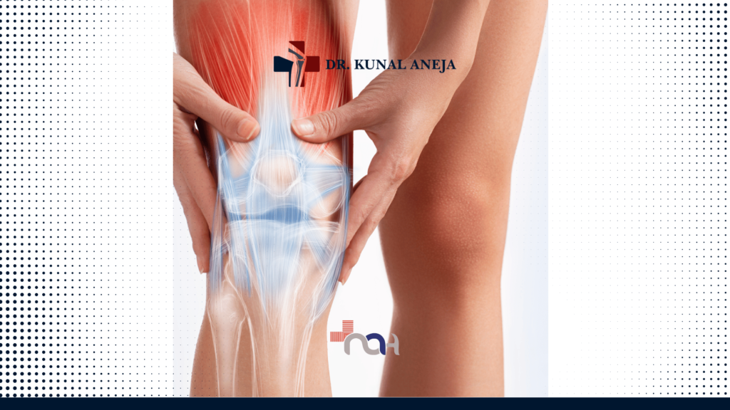 Best knee Preservation in Delhi