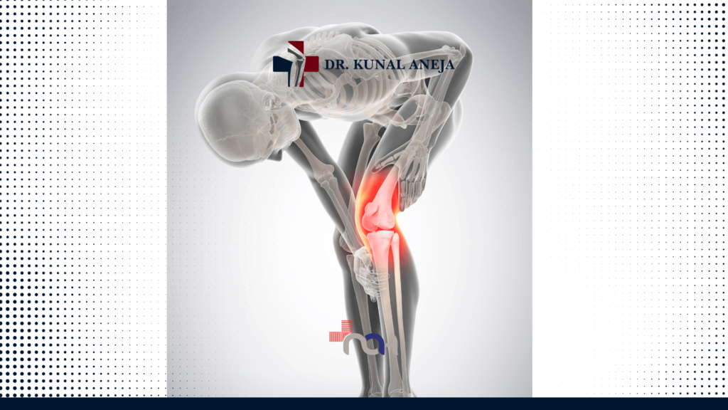 Robotic Knee Replacement surgery
