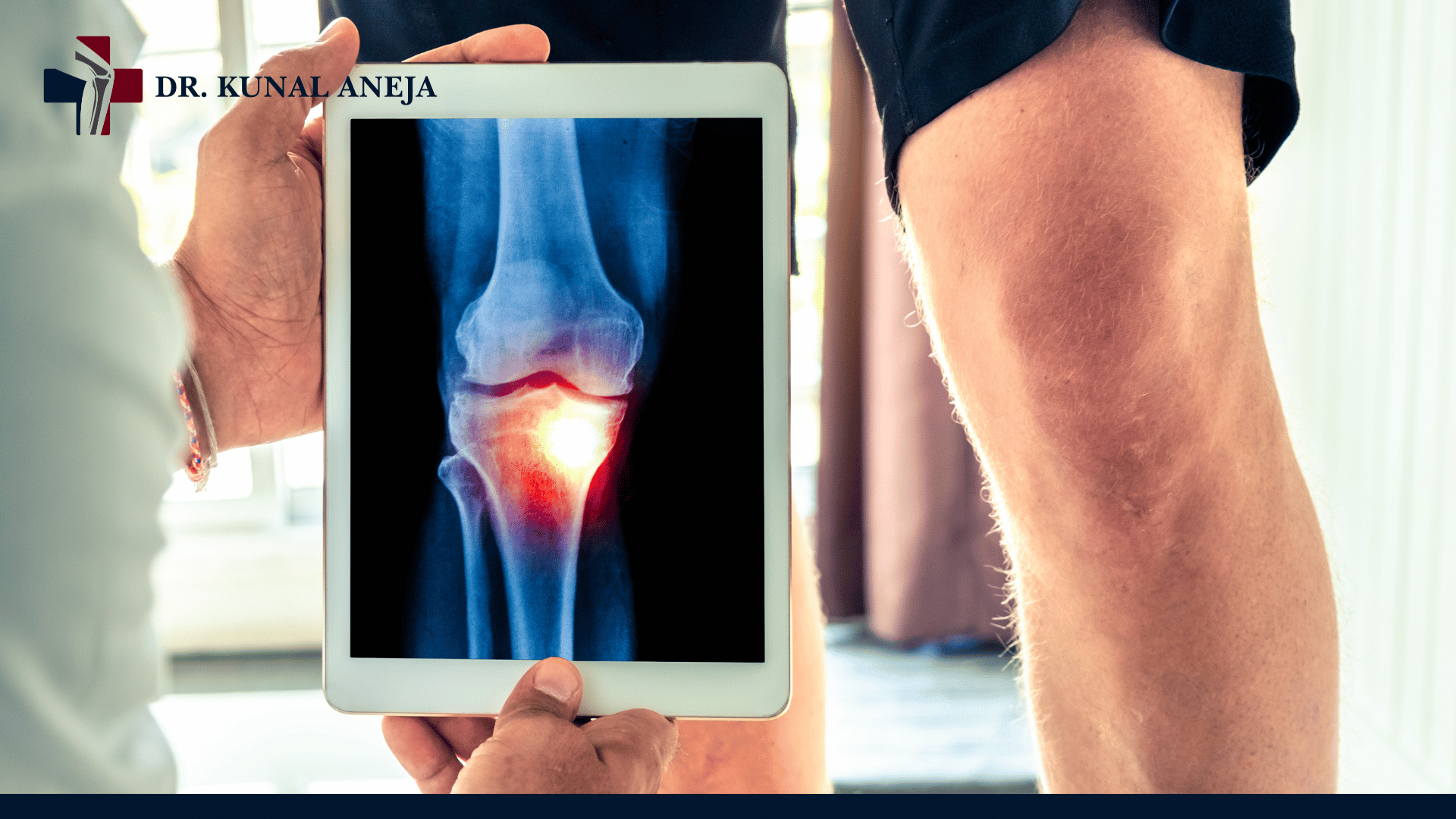 #1 Robotic Knee Replacement Surgeon in Delhi