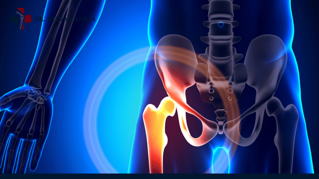 Hip Replacement Surgeon in Delhi