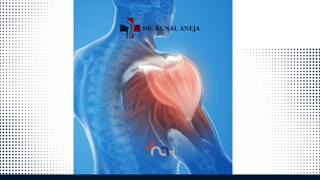 Best Shoulder Arthroscopy Surgeon in Delhi