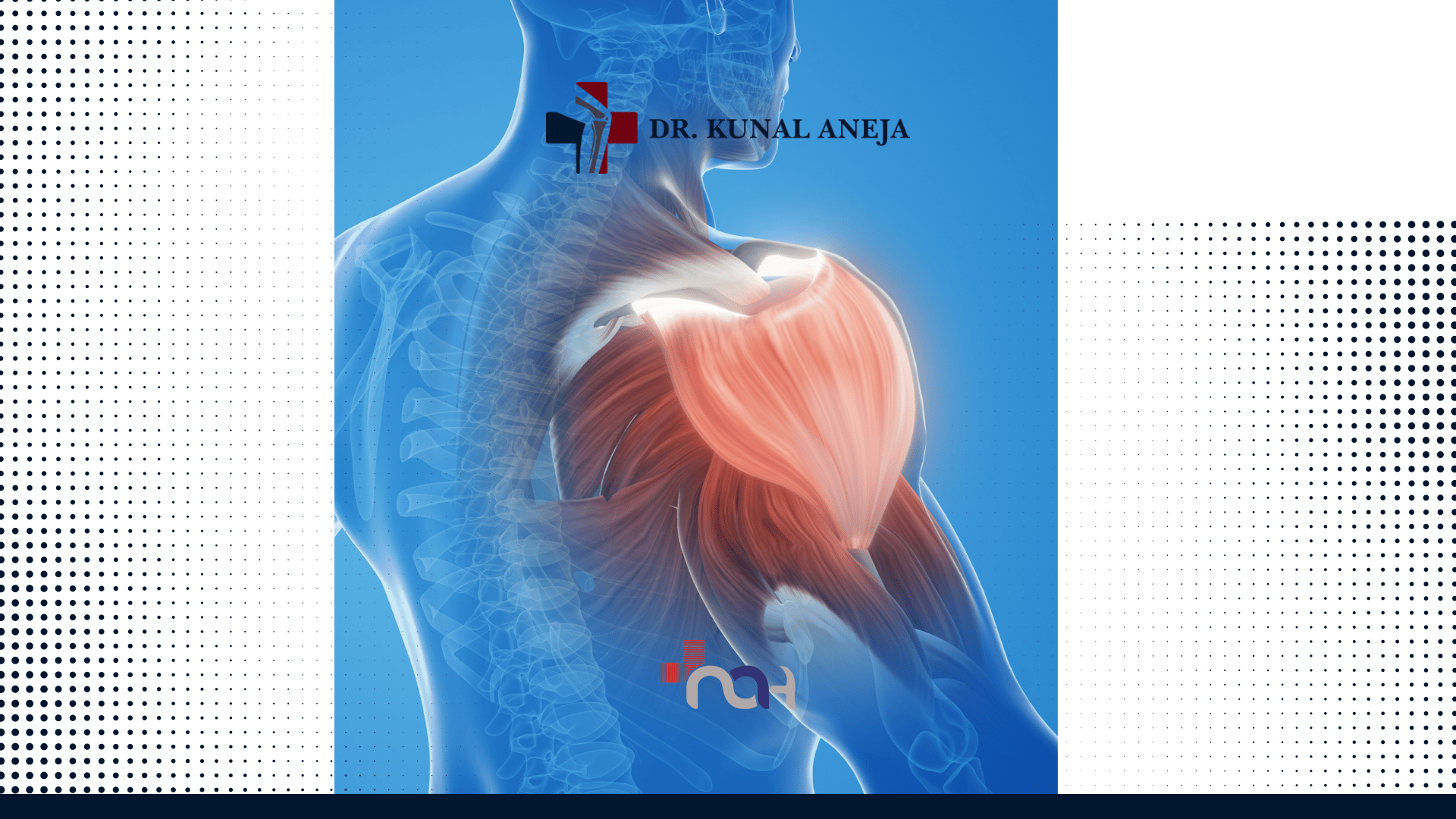 Best Shoulder Arthroscopy Surgeon in Delhi