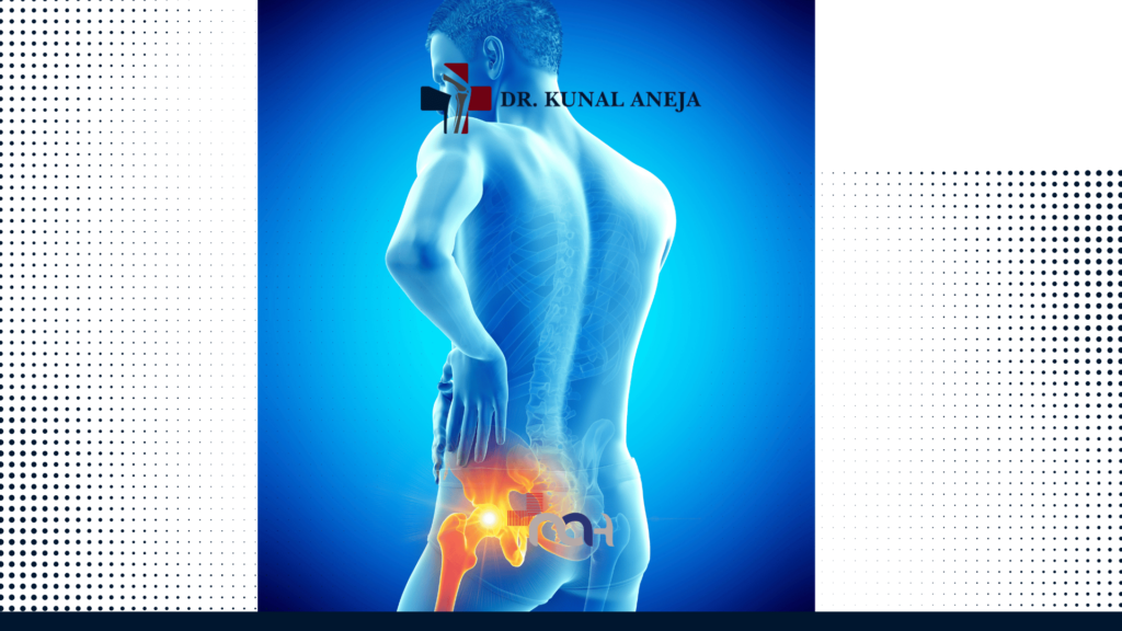 Hip Replacement Surgeon in Delhi