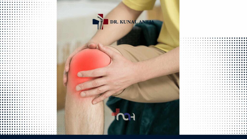 Knee Replacement Surgeon in Delhi