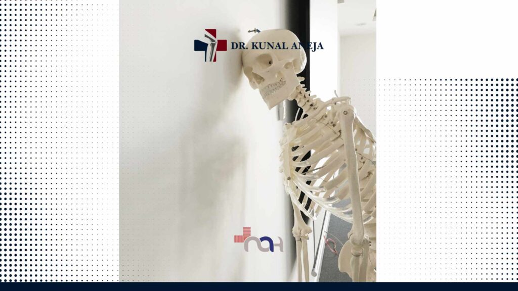 Bone Doctor in Delhi