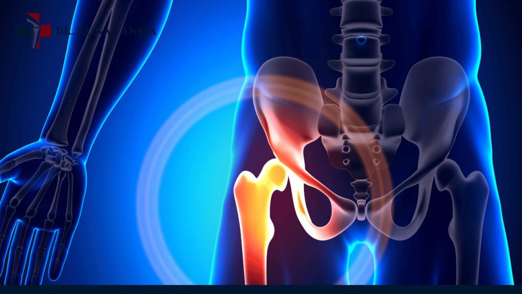 Hip Replacement Surgeon in Delhi
