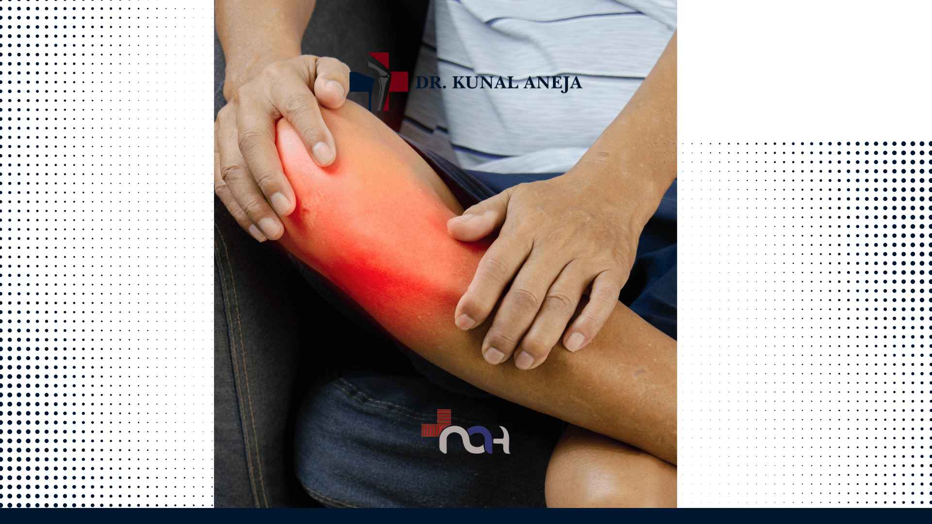 Knee Replacement Surgeon in Delhi