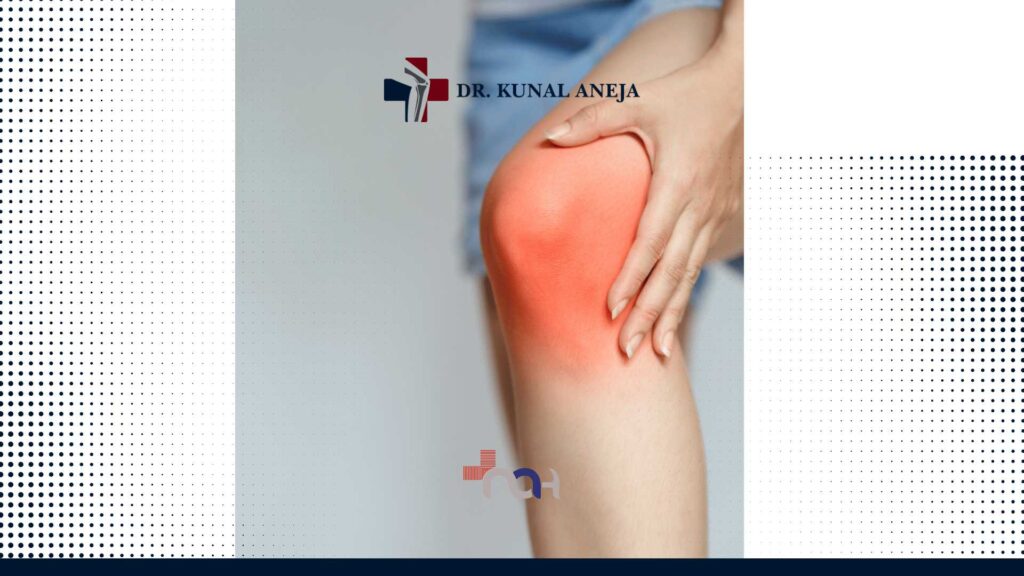 Knee Replacement Surgeon in Delhi