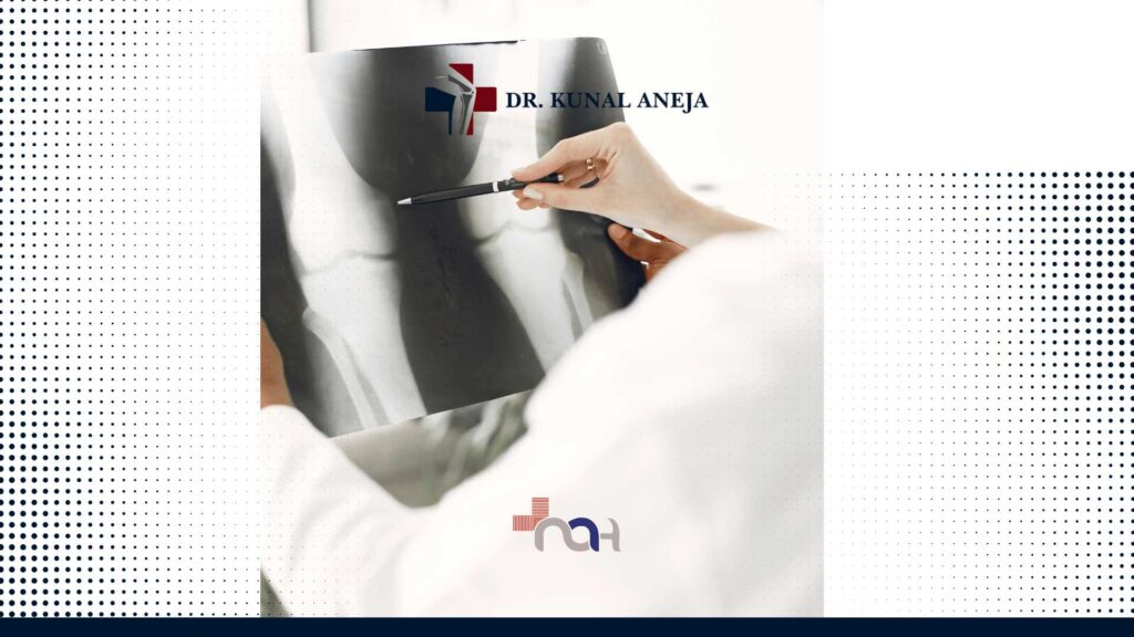Bone Doctor in Delhi