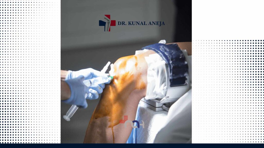 Knee Joint Replacement Surgeon in India