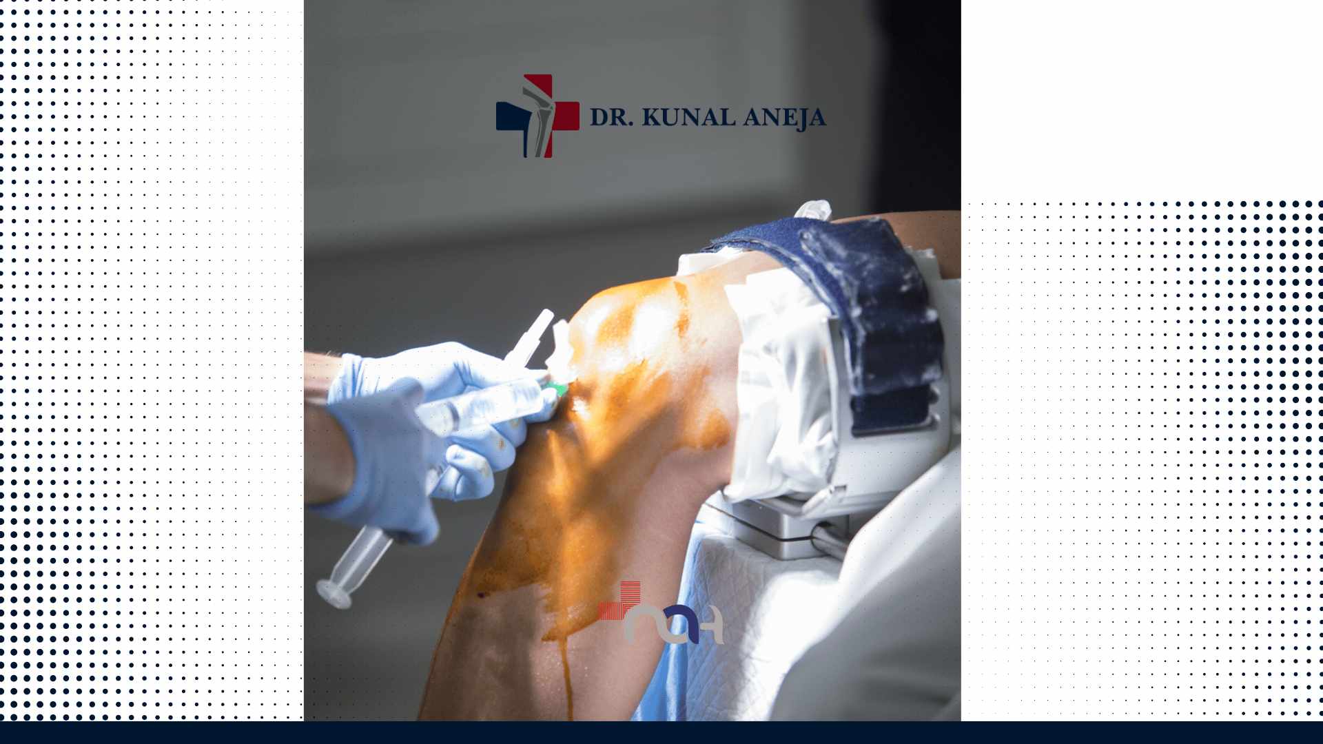 Knee Joint Replacement Surgeon in India