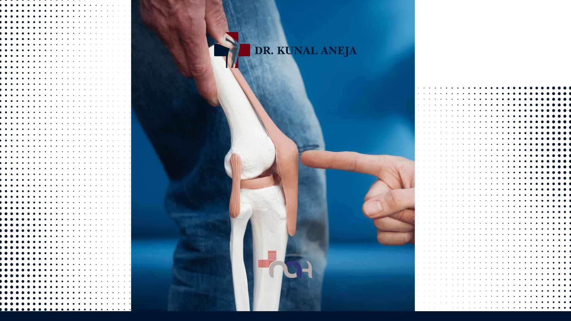 Best Robotic Knee Replacement in India
