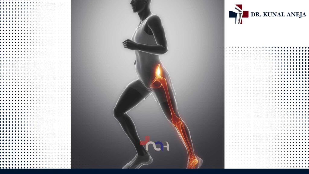 Hip and Knee Replacement Surgeon in India