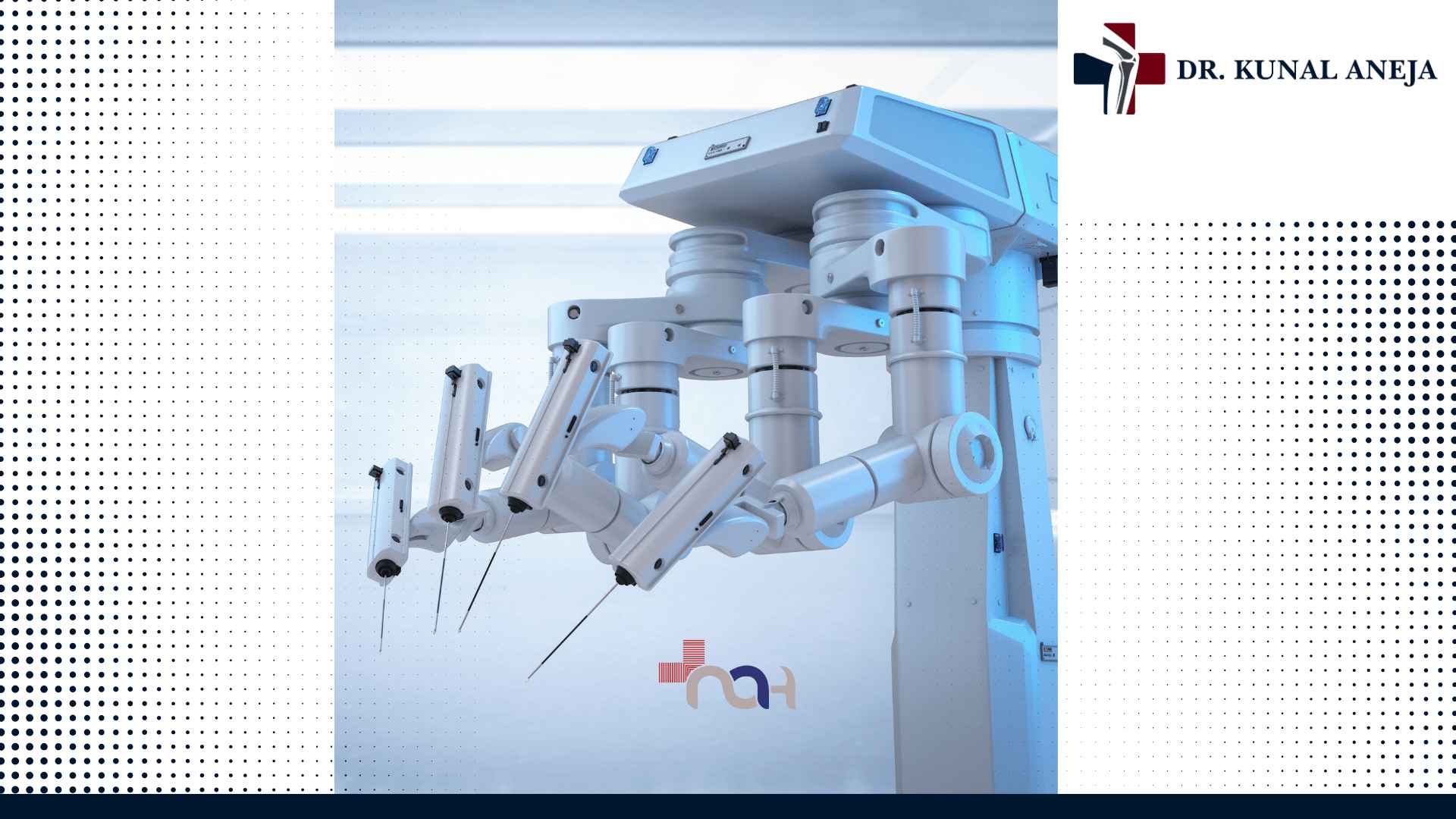 Robotic knee replacement surgery in India