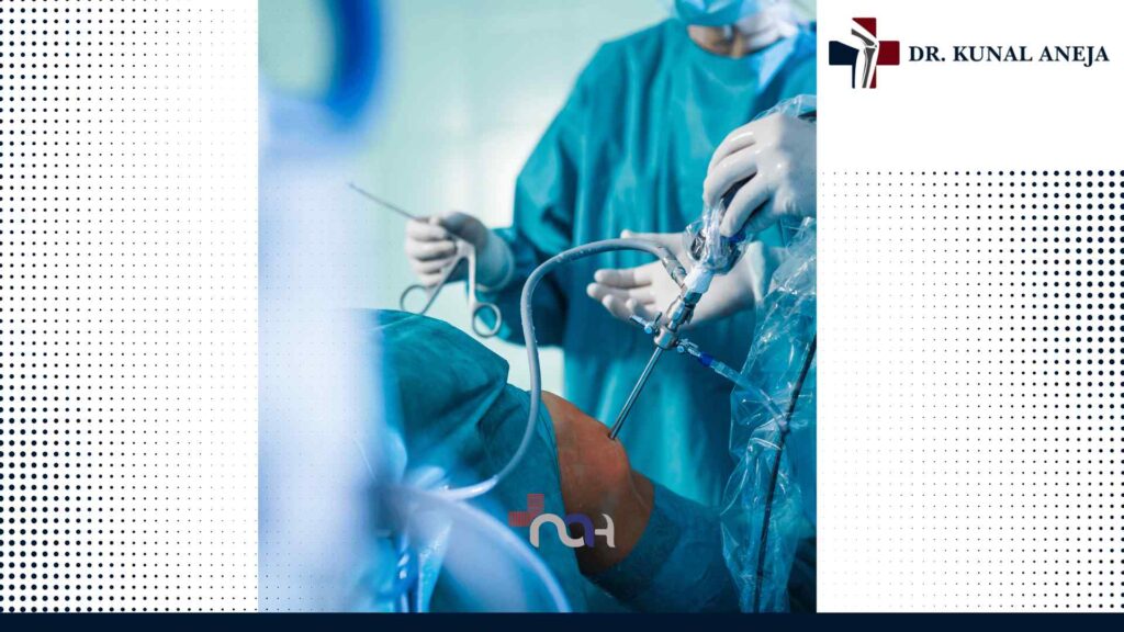 Best Knee Replacement Surgeon in Delhi