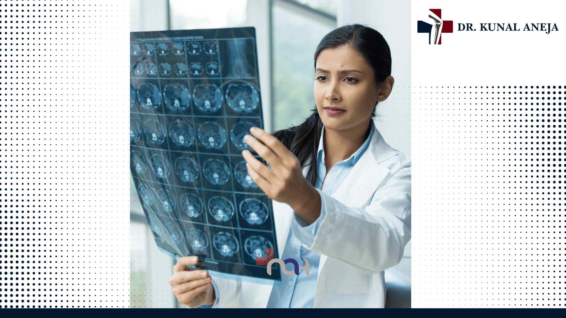 Joint Replacement Surgeon in Delhi