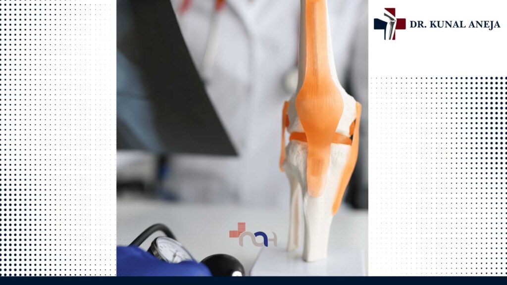 Total Knee Replacement in Delhi