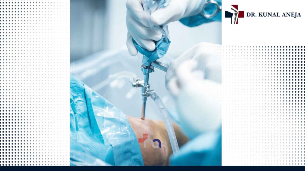 Best knee replacement surgeon in Delhi