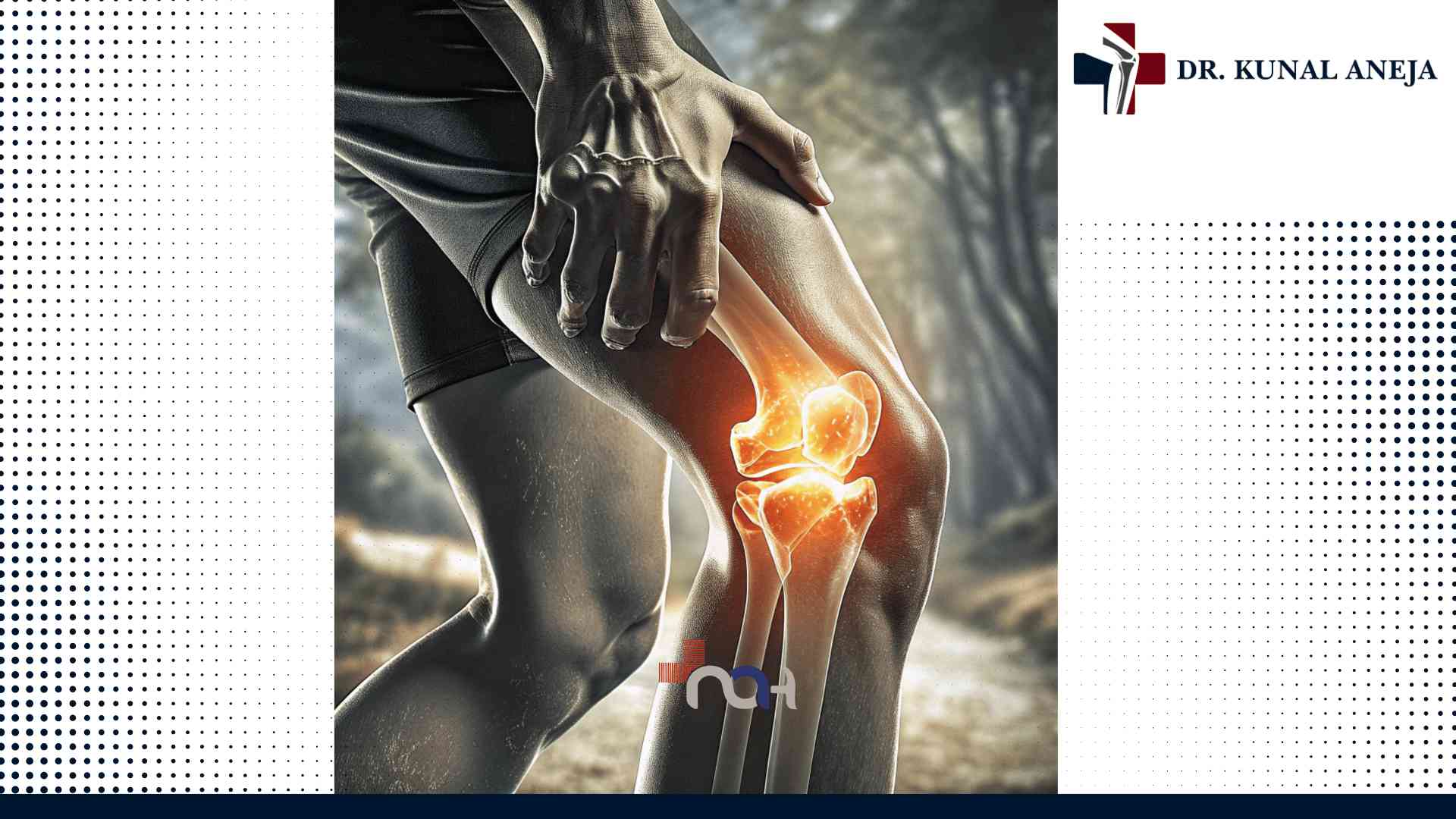 Best Knee Replacement Surgeon in Delhi