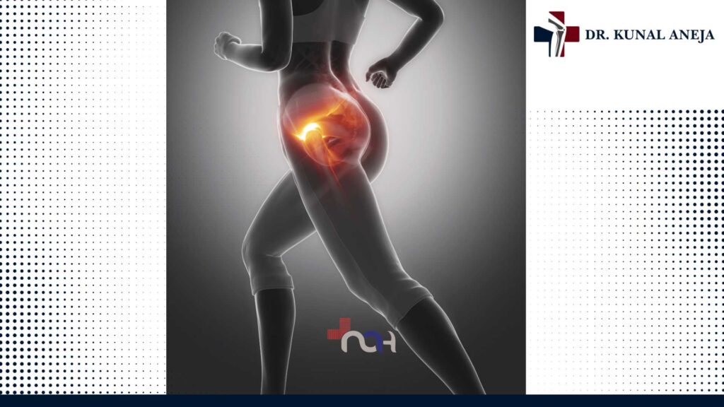 Best Sports Injury Specialist in Delhi