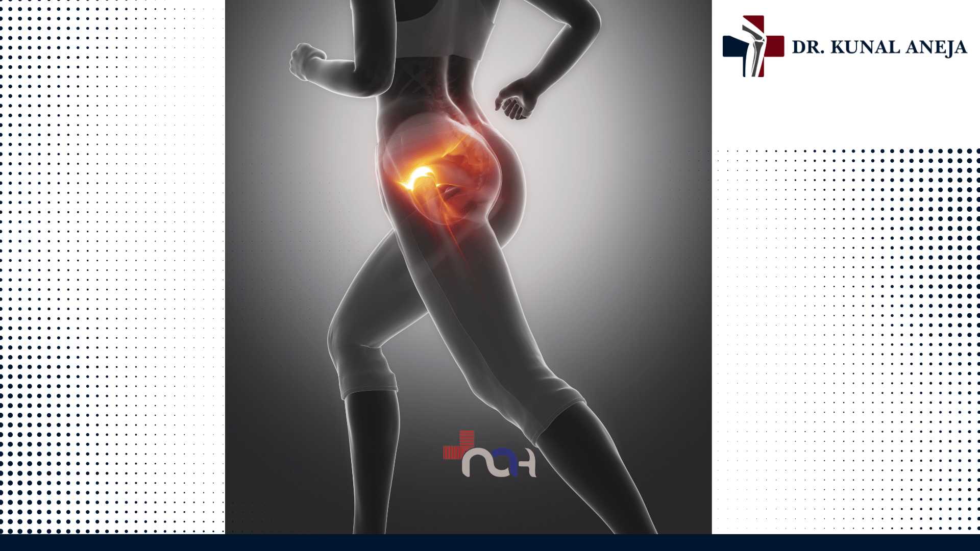 Best Sports Injury Specialist in Delhi