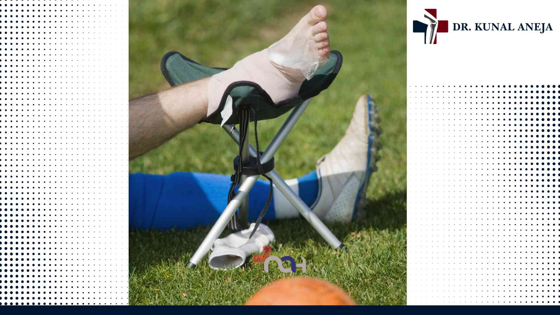 Doctor for ACL Surgery in Delhi