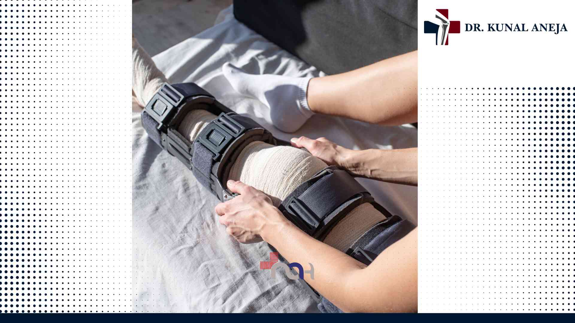 knee replacement surgeon in delhi