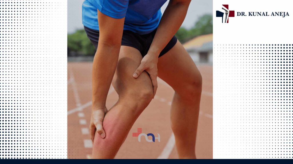 Best Sports Injury Specialist in Delhi